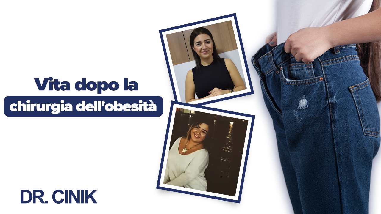 risultati della chirurgia dell'obesità prima e dopo